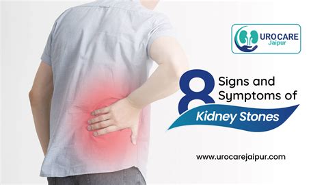 Female Signs Of Kidney Stones