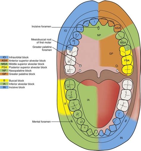 Image result for Single Tooth Root Nerve Block