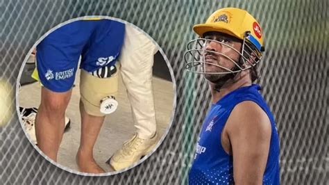 MS Dhoni injury: Dhoni was injured during IPL – now the knee operation ...