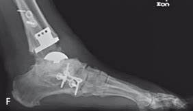 Hardware Monitor Driver 的图像结果