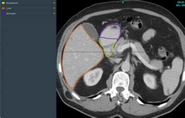 aiTouch - Data Science, Artificial Intelligence, Annotations, Analytics