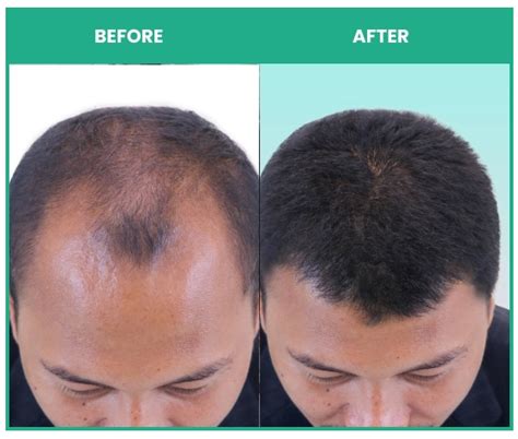 ThriveCo Rosemary Hair Conditioner For Voluminous Hair