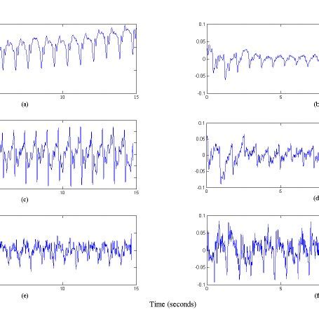 Image result for R-R Interval Calculation for ECG Code in Python