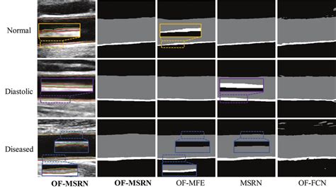 Image result for Normal Blood Segmenter Values