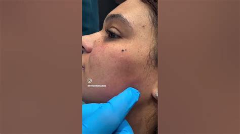 Image result for Tutorial Prophilo