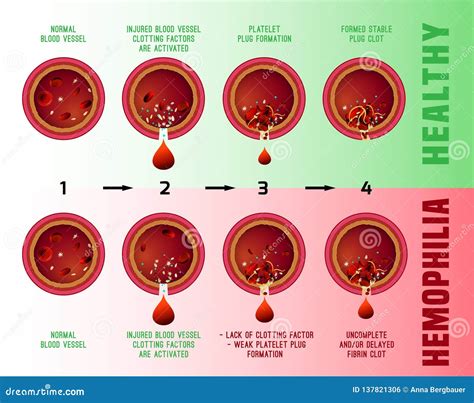 Phases Of Blood Clotting
