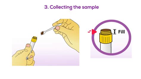 Image result for Stool Sample Collection Procedure
