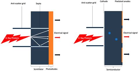 Dual-Source Photon-Counting Computed Tomography—Part I: Clinical ...