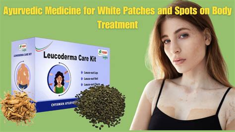 Ayurvedic Medicine for White Patches and Spots on Body Treatment