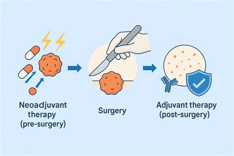 Neoadjuvant And Adjuvant Therapy: Complete Cancer Guide