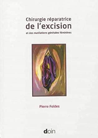 Amazon.in: Buy Chirurgie reparatrice de l'excision et des mutilations ...