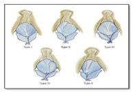 Medpulse Volume 10 Issue 3