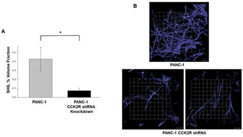 CCK Receptor Inhibition Reduces Pancreatic Tumor Fibrosis and Promotes ...