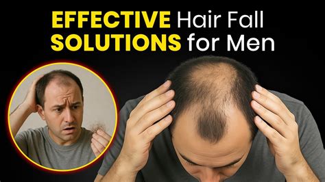 Effective Hair Fall Solutions for Men | Discover Qazila’s Top Picks