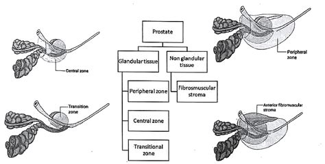 Prostate Gland: Miscellaneous - Medical Science Optional Notes for UPSC ...