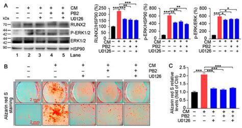 Procyanidin B2 Reduces Vascular Calcification through Inactivation of ...