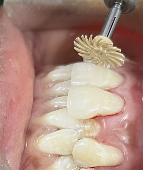 BORAD DENTAL WELLNESS & IMPLANT