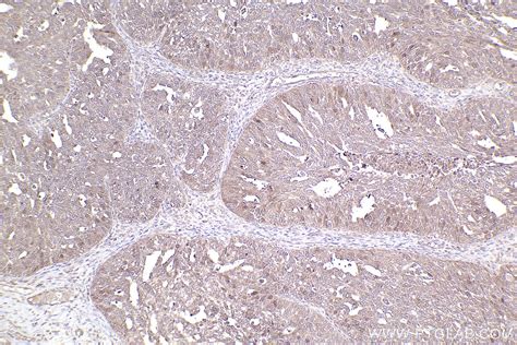 IHCeasy RAB35 Ready-To-Use IHC Kit KHC2484 | Proteintech