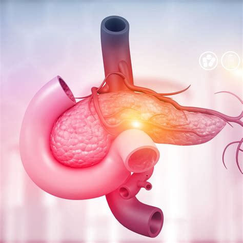 Die intraduktale papillär-muzinöse Neoplasie – eine interdisziplinäre ...