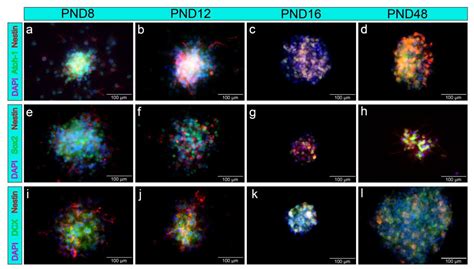 Adult Neurogenesis of the Medial Geniculate Body: In Vitro and ...