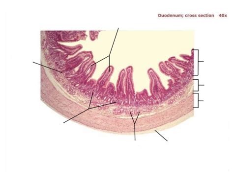 Image result for Duodenum Part
