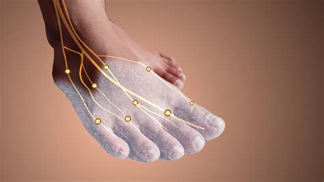 Acupuncture and Its Benefits in Peripheral Neuropathy | AWC