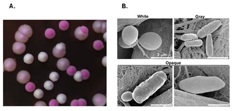 感染念珠菌的九种症状和三种调理方法_传染病知识_上海凯创生物技术有限公司