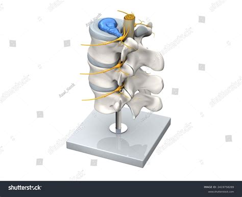 Disk Problem 的图像结果