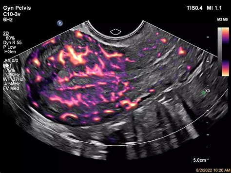 Philips - Affiniti 70 Ultrasound system