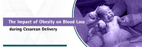 Obesity and Blood Loss: Risks During Cesarean Delivery