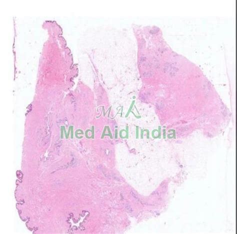 Mammary Gland Nipple Histology Slide Manufacturer, Supplier from Noida