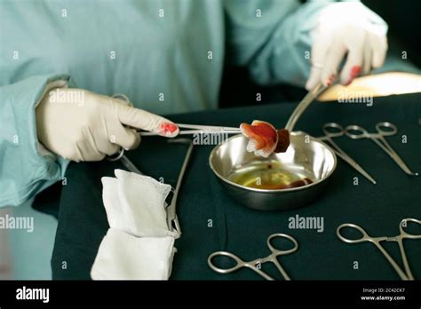 Image result for Tissue Sample during Surgery