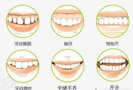 专家提醒：七成牙齿松动不需要拔除！4种办法能够固定松牙！ - 知乎