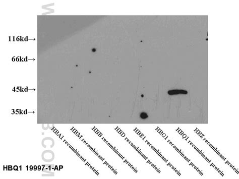 HBQ1-Specific antibody (19997-1-AP) | Proteintech