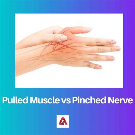 Pulled Muscle vs Pinched Nerve: Difference and Comparison