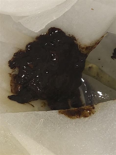 Black Coffee Cause Diarrhea at Lindy Rossi blog