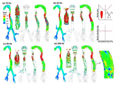 Flow Dynamics and Acoustics from Glottal Vibrations at Different ...