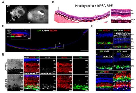 Transplantation of Human Induced Pluripotent Stem Cell-Derived Retinal ...