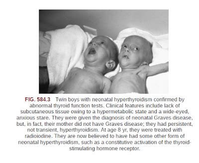 NEONATAL GRAVES