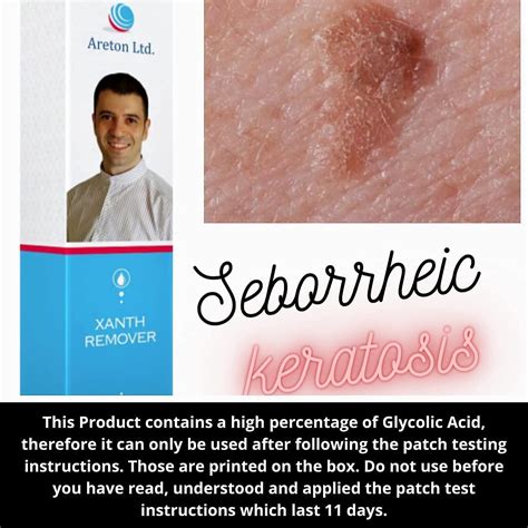 The Seborrheic Keratosis Removal Glycolic Acid Peel Solution The Specialised | Desertcart Kenya