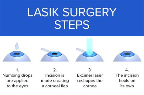 Epi-LASIK Eye Surgery - How Epi-LASIK Works, and What To Expect
