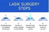 Epi-LASIK Eye Surgery - How Epi-LASIK Works, and What To Expect