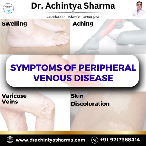 Peripheral Venous Disease: Symptoms, Causes, Treatments
