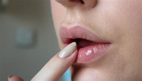 20 DIY Remedies For Dark Lips - lifeberrys.com