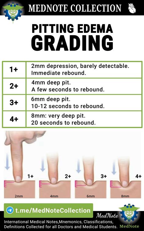 PITTING EDEMA GRADING | Medical school stuff, Nursing school survival, Medical school essentials