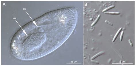Diversity | Special Issue : Biodiversity of Ciliates and their Symbionts