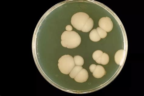 白色念珠菌：存在于我们之中的危险真菌-查士利华微生物应用技术（上海）有限公司