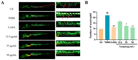 Altechromone A Ameliorates Inflammatory Bowel Disease by Inhibiting NF ...
