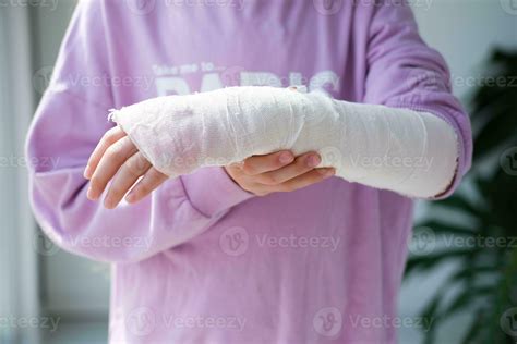 Broken Hand Cast