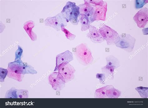 Epithelial Cells Under Microscope